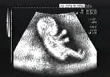 ШОФЕР