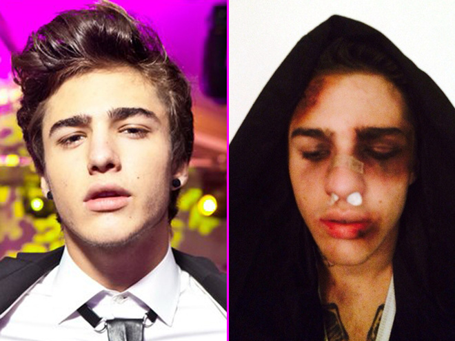 Рома Жолудь