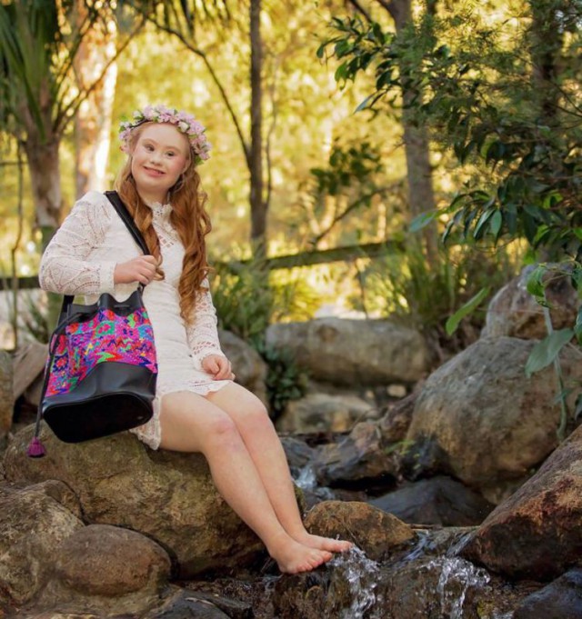 Девушка с синдромом Дауна стала моделью