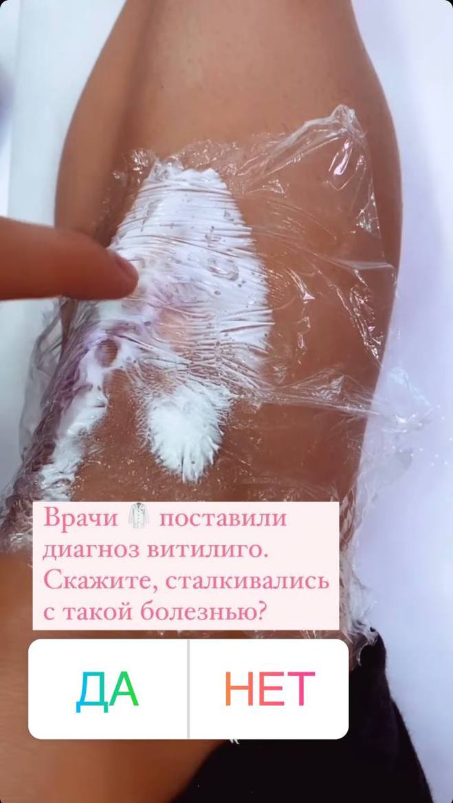 Регина Тодоренко
