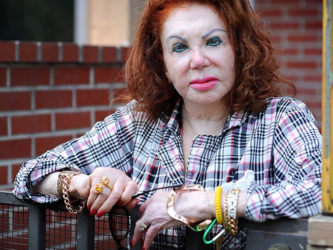 Жертвы пластической хирургии