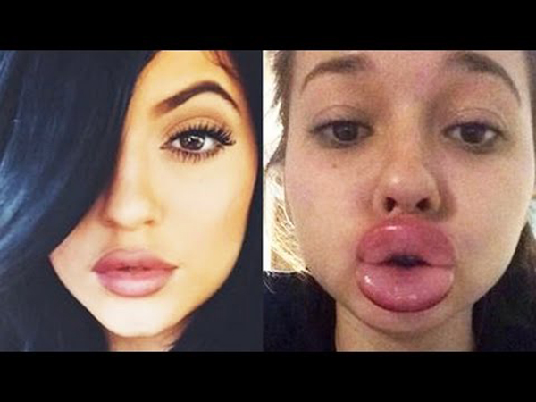 Вызов Кайли Дженнер