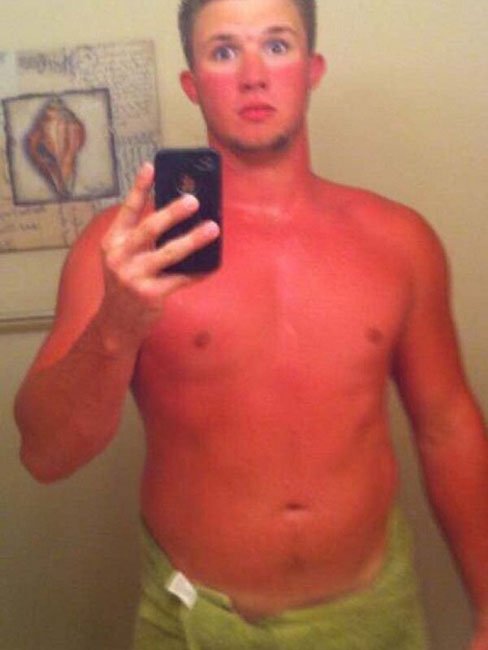 Как не стоит загарать